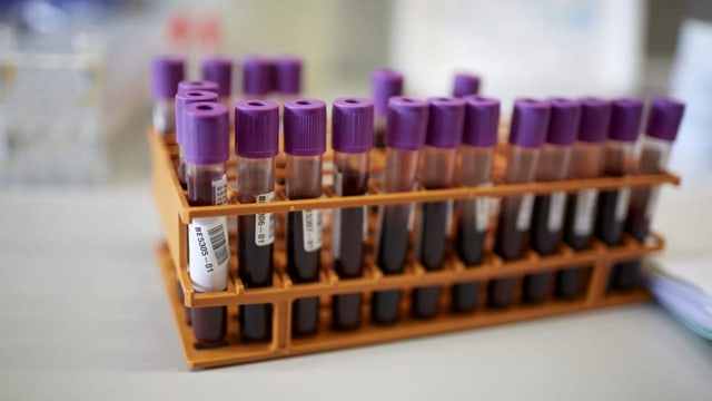 Wie umgehen mit neuen Alzheimer-Bluttests?