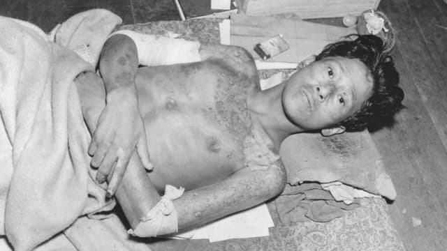 Nagasaki: Was bleibt im Körper, der Psyche und der Gesellschaft?